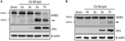 Cleavage of Grb2-Associated Binding Protein 2 by Viral Proteinase 2A during Coxsackievirus Infection